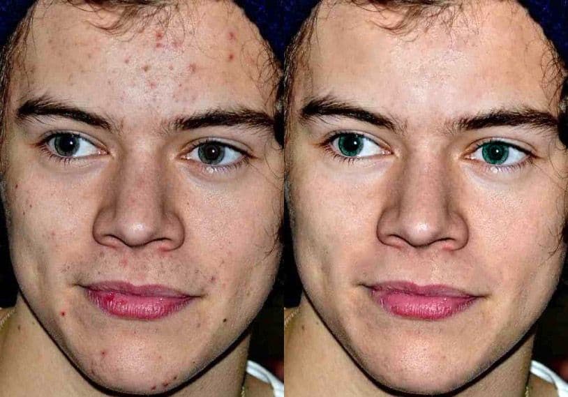 Tired, dull skin to Clear, glowing skin