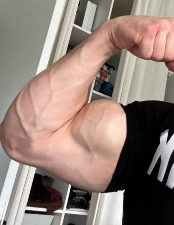 How Much Protein Do You Really Need to Build Muscle?